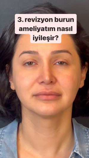 Video post by @dr.mehmetcomert on Instagram