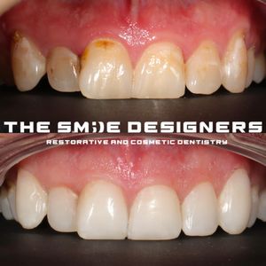 Image post by @fahaddentist on Instagram