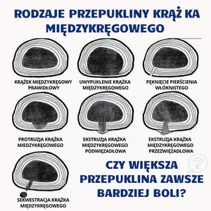 Image post by @neurochirurg_litak on Instagram