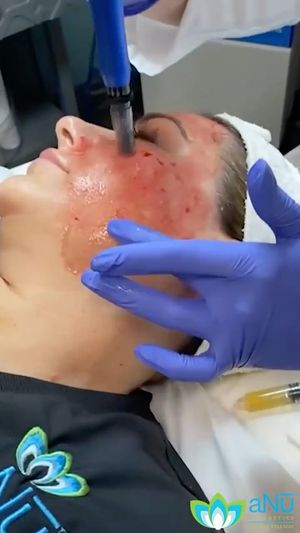 Video post by @anuaestheticsandwellness on Instagram