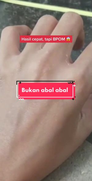Video post by @lili.refliskin on TikTok
