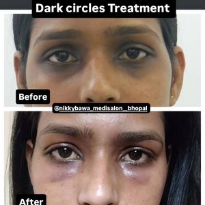 Image post by @nikkybawamedisalonbhopal on Instagram