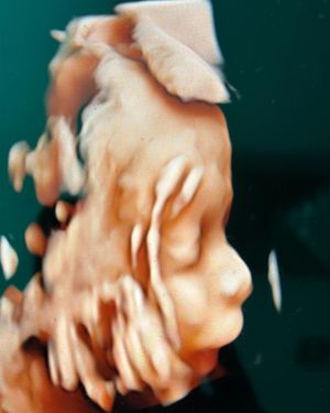Image post by @dr.aliriogrisanti on Instagram
