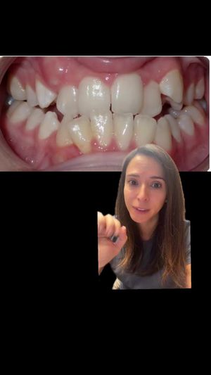 Video post by @weisstorortho on TikTok