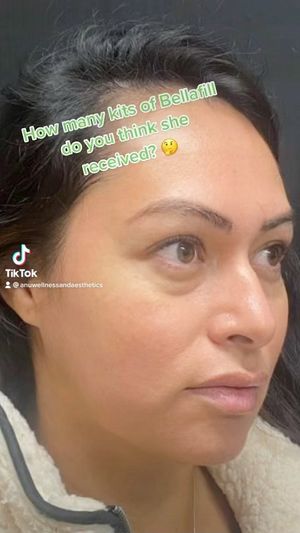 Video post by @anuaestheticsandwellness on Instagram