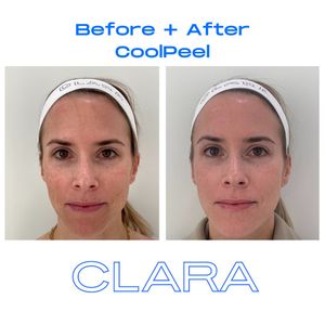 Image post by @clara.derm on Instagram