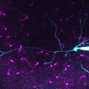 Image post by @neurochirurg_litak on Instagram