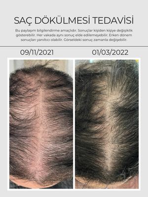 Image post by @drozlemteberik on Instagram