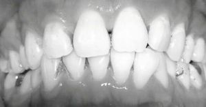 Video post by @drrezdental on Facebook