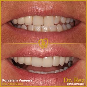 Image post by @drrezdental on Facebook