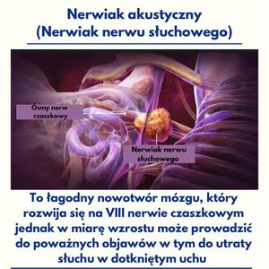 Image post by @neurochirurg_litak on Instagram
