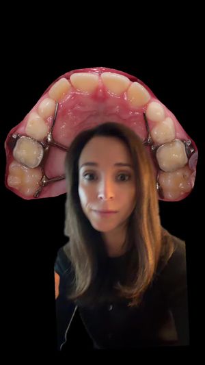 Video post by @weisstorortho on TikTok