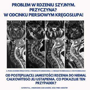 Image post by @neurochirurg_litak on Instagram