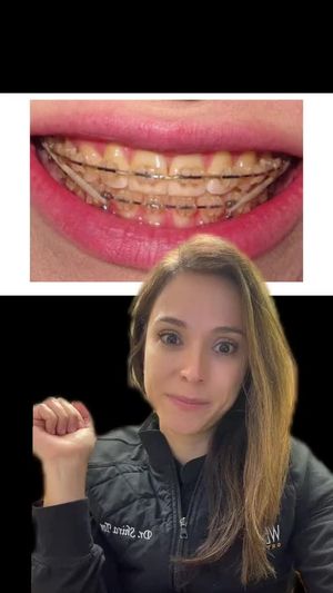 Video post by @weisstorortho on TikTok