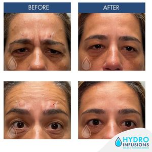 Image post by @hydromedspa on Facebook