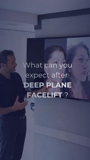 Video post by @dr.mehmetcomert on Instagram