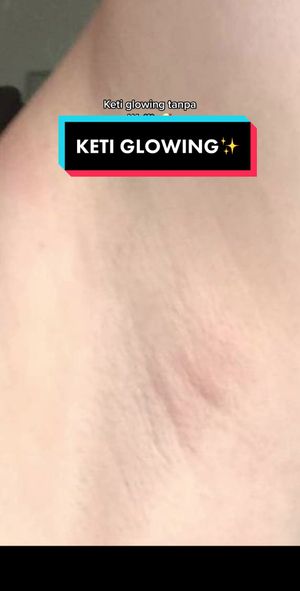 Video post by @lili.refliskin on TikTok