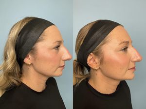 Image post by @beer_dermatology on Instagram