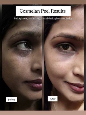 Image post by @nikkybawamedisalonbhopal on Instagram