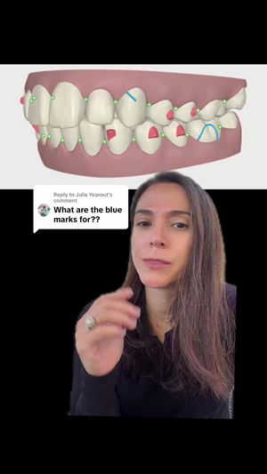 Video post by @weisstorortho on TikTok