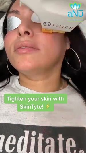 Video post by @anuaestheticsandwellness on Instagram