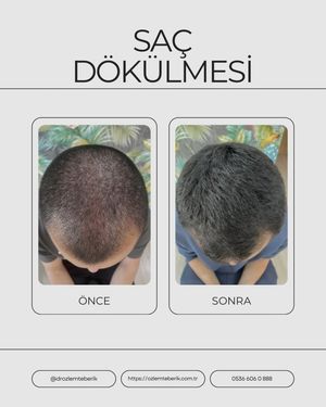 Image post by @drozlemteberik on Instagram