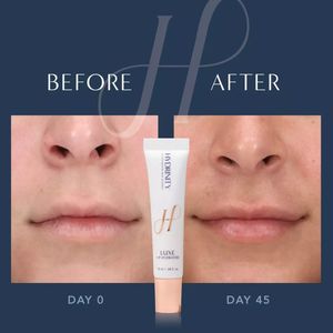 Image post by @hydrinity_skincare on Instagram
