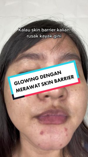 Video post by @lili.refliskin on TikTok
