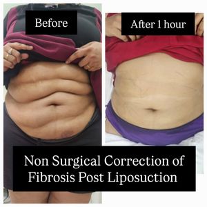 Image post by @nikkybawamedisalonbhopal on Instagram