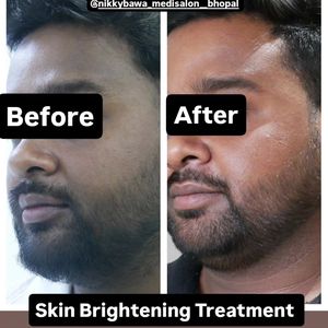 Image post by @nikkybawamedisalonbhopal on Instagram