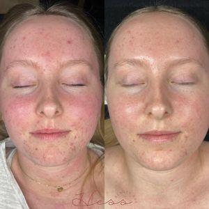 Image post by @HessBeautyBar on Facebook