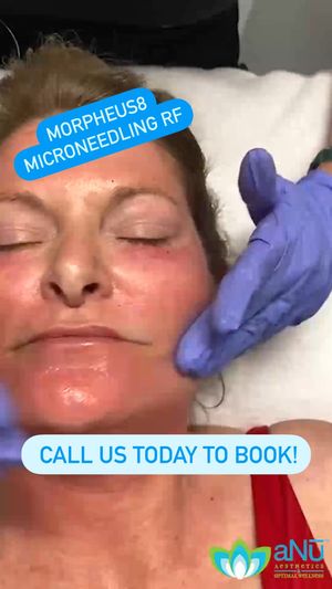 Video post by @anuaestheticsandwellness on Instagram