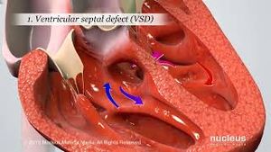 Video post by @nucleusmedicalmedia on YouTube