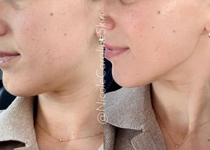 Image post by @nicolecarolineskin on Instagram