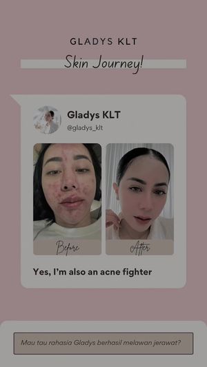 Video post by @gladysklt on TikTok