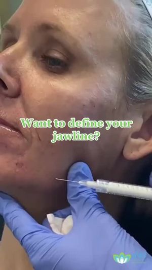 Video post by @anuaestheticsandwellness on Instagram