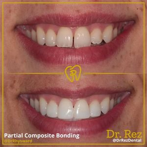 Image post by @drrezdental on Facebook