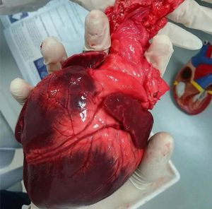 Image post by @dr.bekircakmak on Instagram