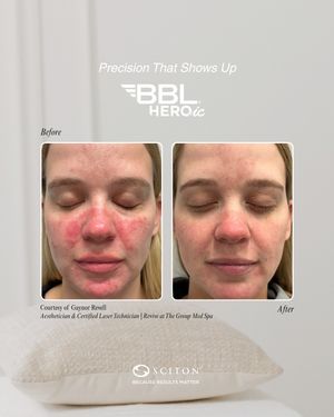 Image post by @sciton_inc on Instagram
