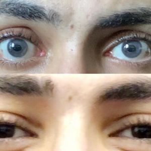 Image post by @irexlaser on Instagram