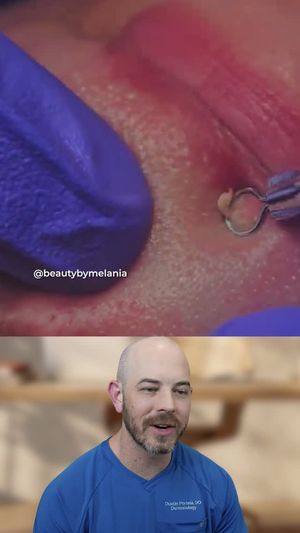 Video post by @drdustinportela on Instagram