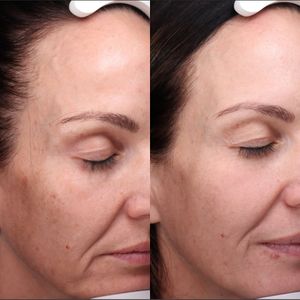 Image post by @myskinspecialist on Instagram