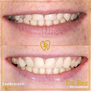 Image post by @drrezdental on Facebook