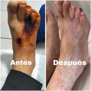 Image post by @dr.vicentevascular on Instagram
