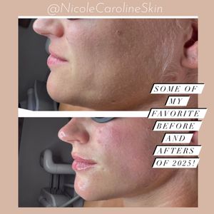 Image post by @nicolecarolineskin on Instagram