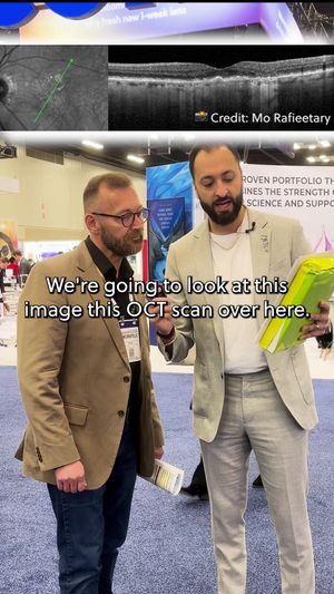 Video post by @eyesoneyecare on TikTok