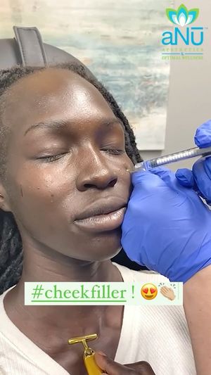 Video post by @anuaestheticsandwellness on Instagram