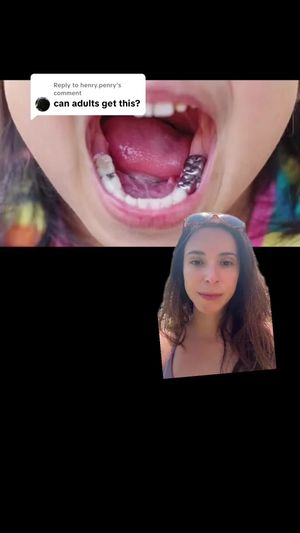 Video post by @weisstorortho on TikTok
