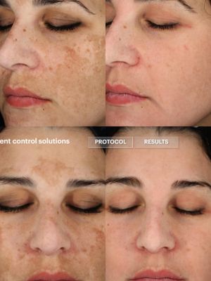 Image post by @leyla.skincareandbeauty on Instagram