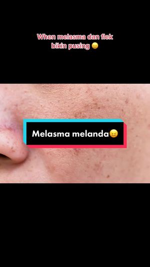 Video post by @lili.refliskin on TikTok